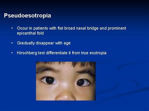 Clinical features include microbrachycephaly with a flat occiput, and characteristic facies including epicanthal folds, a flat nasal bridge. Flat Nasal Bridge And Epicanthal Folds : Epicanthic Folds ...