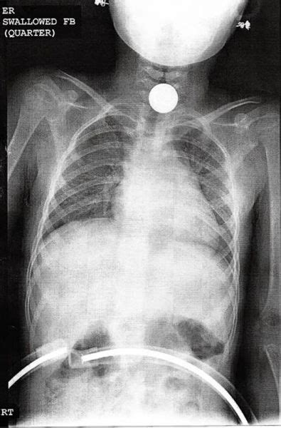 Real X Rays That Will Shock And Astound You Pics Izispicy Com