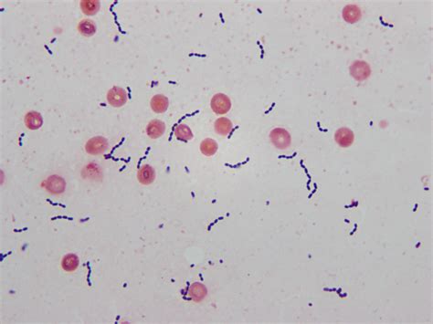 Microbiology Case Study An 8 Week Old Female With Pallor Vomiting