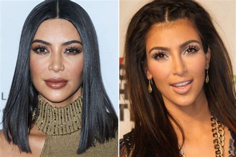 Kim Kardashians Plastic Surgery Timeline In Full As Star Exposes Her