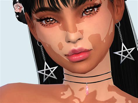 Saruins Skin Detail Vitiligo Set No The Sims Skin Sims Body