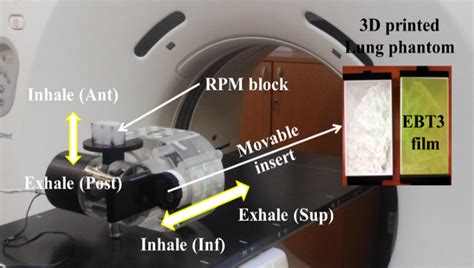 Comparing Phase‐ And Amplitude‐gated Volumetric Modulated Arc Therapy