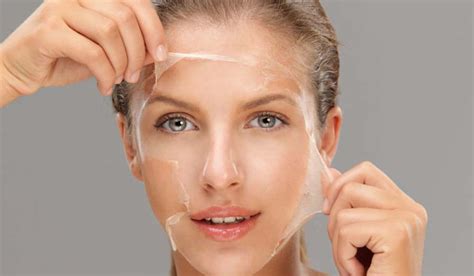 What Can A Chemical Peel Do For Your Skin Luxe Aesthetics