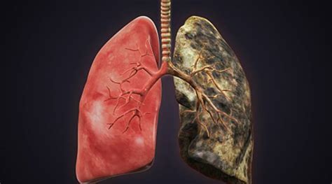 The best (and worst) diets of 2020, according to experts. WATCH: Lungs of smokers vs non-smokers; this viral video ...
