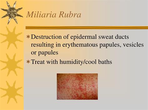 Ppt Papules Purpura Petechia And Other Pediatric Problems A Review