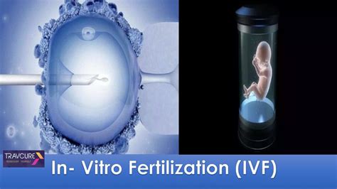 Ppt In Vitro Fertilization Ivf Powerpoint Presentation Free Download Id7663204