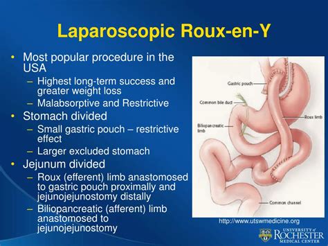 Ppt Imaging Of Bariatric Surgery Normal Anatomy And Postoperative
