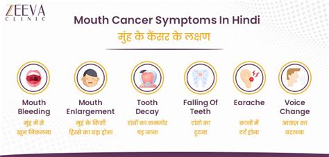 Mouth Cancer Symptoms In Hindi Muh Ka Cancer हिंदी में 2023 Zeeva