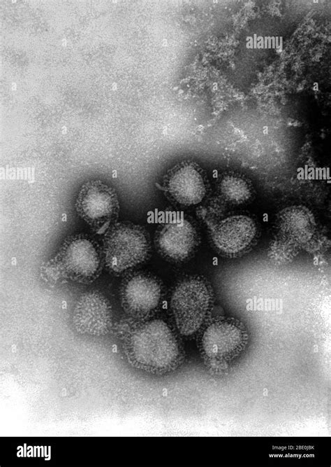 000 Virus De La Influenza A Fotografías E Imágenes De Alta Resolución Alamy