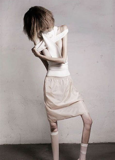 Anorexic Models Dont Always Look Like Models Page 2 Of 2