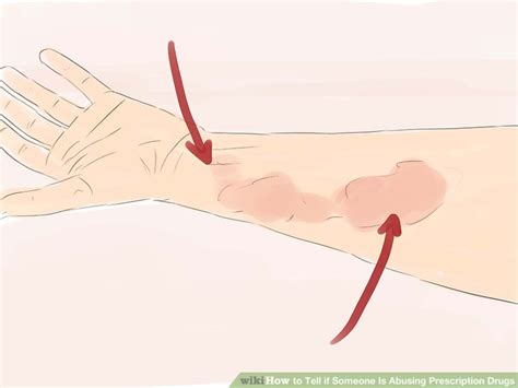 They may be red if eye drops weren't used, even if they were the high will last till it is over and then you will experience the either calming effect of adderall (if add) or the hyped up effect for the adverse effect for persons without add or adhd. 4 Ways to Tell if Someone Is Abusing Prescription Drugs ...