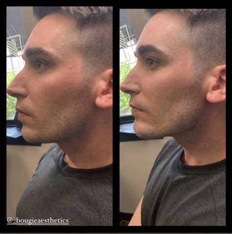 Masculine Face Contouring