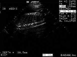 Fetal Spine D Ultrasound Images Of Normal Fetal Spine Service