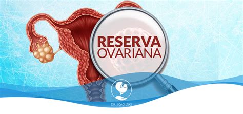 O Que Reserva Ovariana E Qual Sua Rela O A Fertilidade Dr