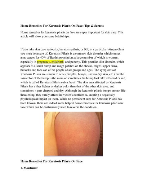 Home Remedies For Keratosis Pilaris On Face Tips And Secrets