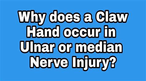 Claw Hand Ulnar And Median Nerve Injury Youtube