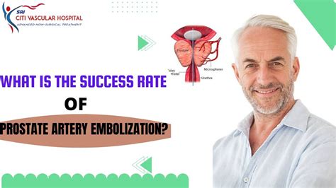 Prostate Artery Embolization Success Vs Common Turp Prostate Surgery
