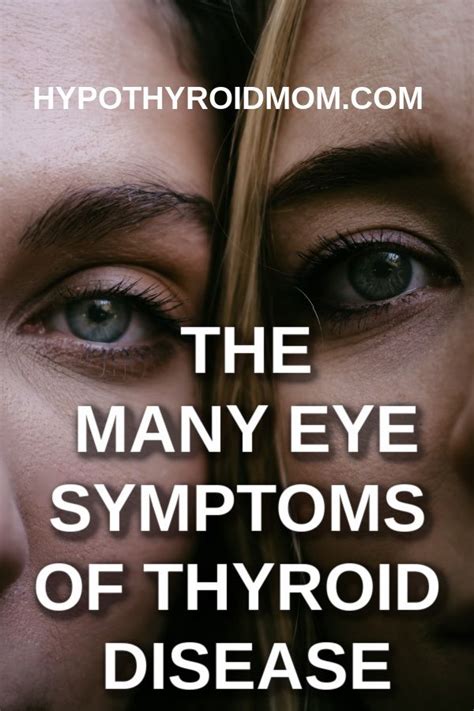 Thyroid Disease And Your Eyes Thyroid Health Thyroid Thyroid Metabolism