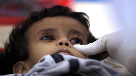Suspected Cholera Cases Reach One Million In Yemen The Hindu
