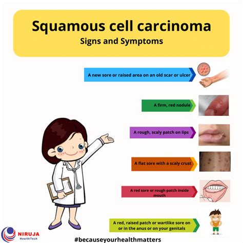 Squamous Cell Carcinoma Signs Symptoms