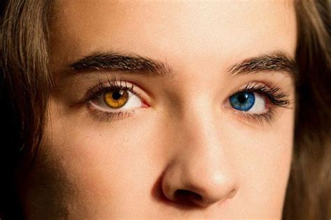 Heterochromia A Beautiful Mutation — Steemit Color De Ojos Fotos