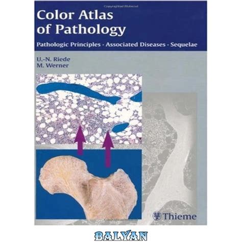 خرید و قیمت دانلود کتاب Color Atlas Of Pathology Pathologic Principles