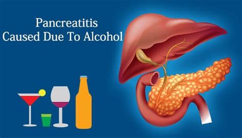 How Much Alcohol Is Too Much Effects Of Drinking Alcohol Alcohol Effects Of Drinking