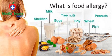 Food allergies occur when your body has an immune response to certain foods. What is Food Allergy? | Symptoms And Treatment ...