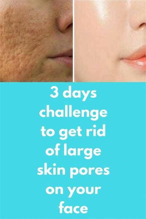 3 Days Challenge To Get Rid Of Large Skin Pores On Your Face
