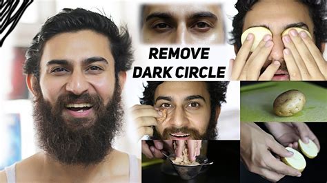 Remove Dark Circles 100 Naturally Potato Home Remedy For Dark