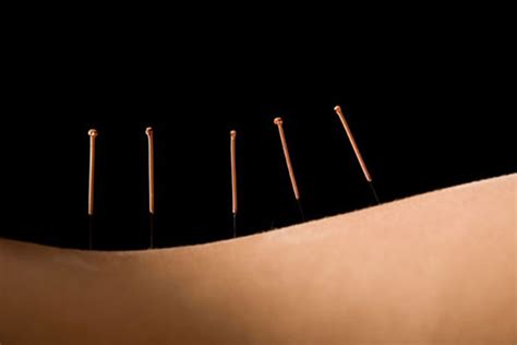 therapies regenerate acupuncture and herbs