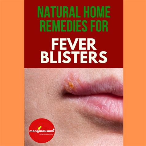 Natural Home Remedies To Treat A Fever Blister Fever Blister Fever