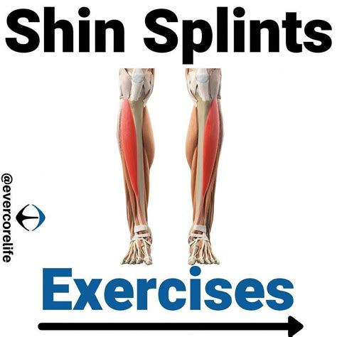 Shinsplintsexercisesstretches Shin Splints Shin Splint Exercises