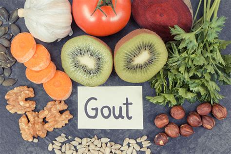 Which Foods Cause Gout Dr Naveen Bhadauria Private Rheumatologist