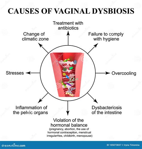 Causes Of Vaginal Dysbiosis Vaginitis Candidiasis Infographics Sexiezpicz Web Porn