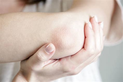 Dry Skin Elbow Stock Photos Pictures And Royalty Free Images Istock