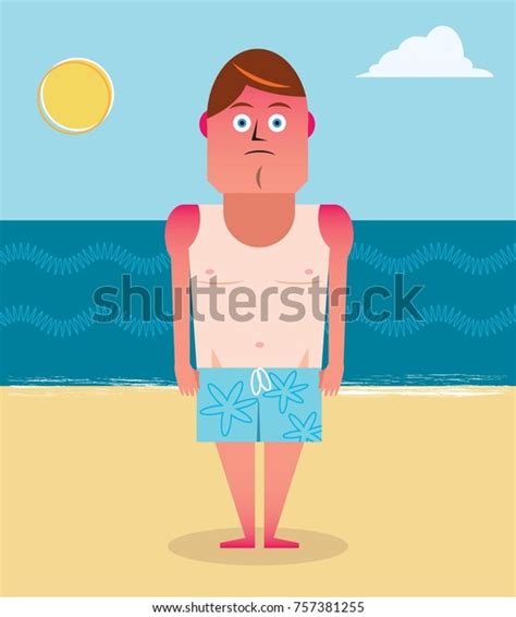 Sunburnt Man On Beach Stock Vector Royalty Free 757381255 Shutterstock