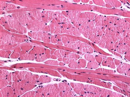 O tecido muscular é formado por células alongadas e especializadas em