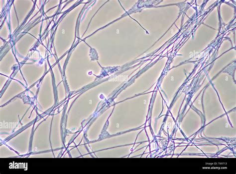 Photomicrograph Of The Mycelia Conidiophores And Conidia Of The