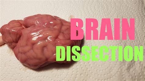Brain Dissection Youtube