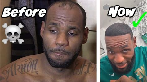 The best memes from instagram, facebook, vine, and twitter about lebron hairline funny. LEBRON JAMES' HAIRLINE HAS BEEN RESTORED! | Lebron hairline