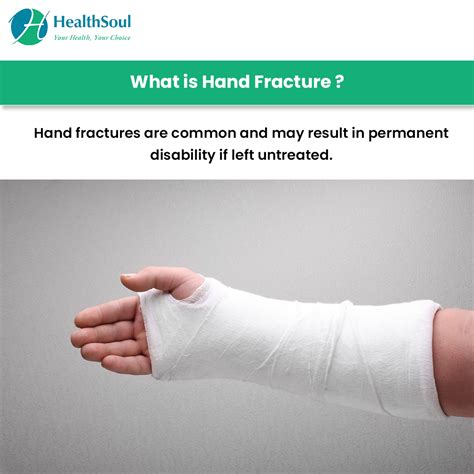Hand Fracture Symptoms And Treatment Healthsoul