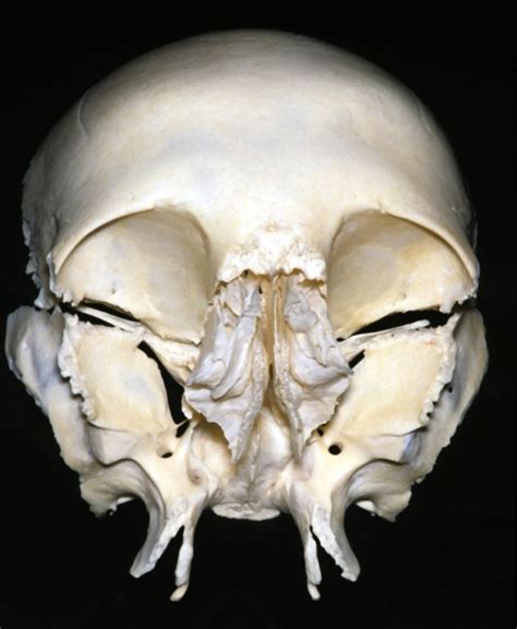 Anterior View of the Frontal, Ethmoid, and Sphenoid Bones