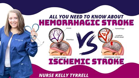 Neuro Disorders Nursing Hemorrhagic Vs Ischemic Stroke Youtube