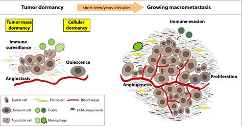 Immunogenic Cellular And Angiogenic Drivers Of Tumor Dormancy‐a