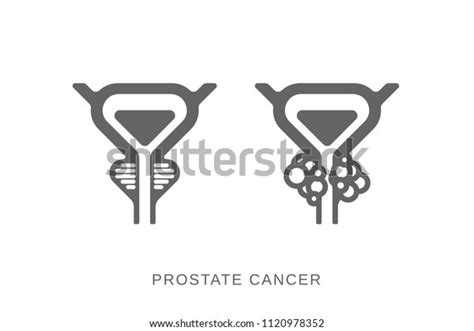 Prostate Gland Icon Prostate Cancer Icon Stock Vector Royalty Free