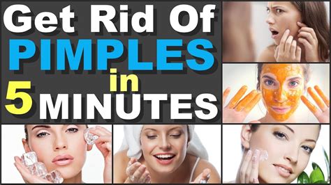 How To Make Pimples Go Away In An Hour Hot Porno