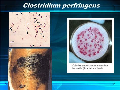 Ppt Clostridium Perfringens History Powerpoint Presentation Free My Xxx Hot Girl