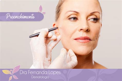 Dra Fernanda Lopes Dermatologia Blog Preenchimento