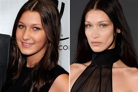 Bella Hadid Nose Job Before And After Photos The Us Sun